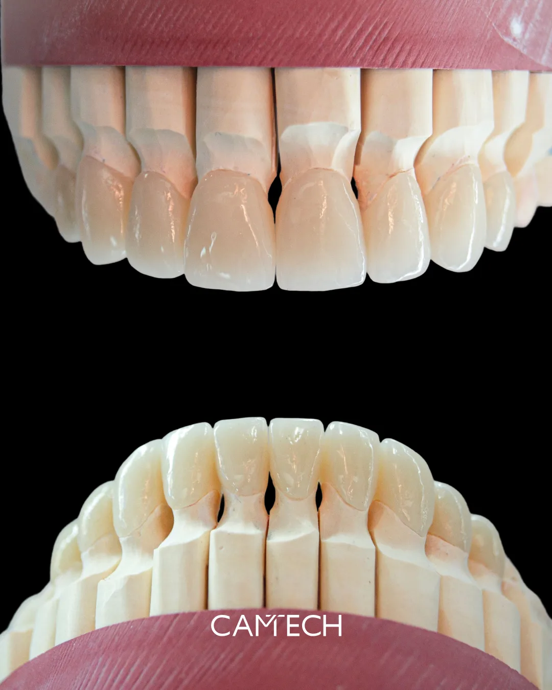 🦷 Фронтальная группа: где заканчивается эстетика и начинается функциональная ошибка?
