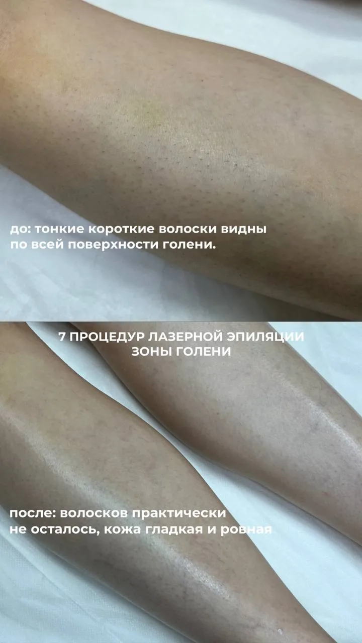 И нам это особенно приятно, ведь мы нацелены не просто сделать процедуру, а дать вам ре...