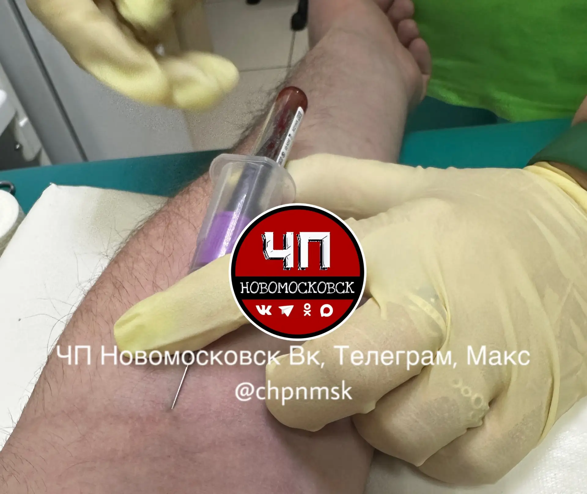 ❗️Тульский Роспотребнадзор сообщил о 4 575 случаях заболевания ОРВИ