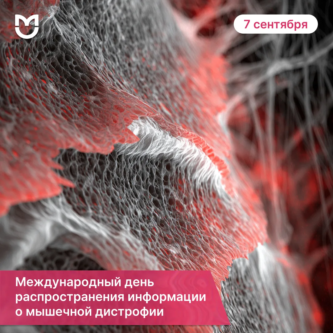 Современная помощь детям с мышечной дистрофией Дюшенна