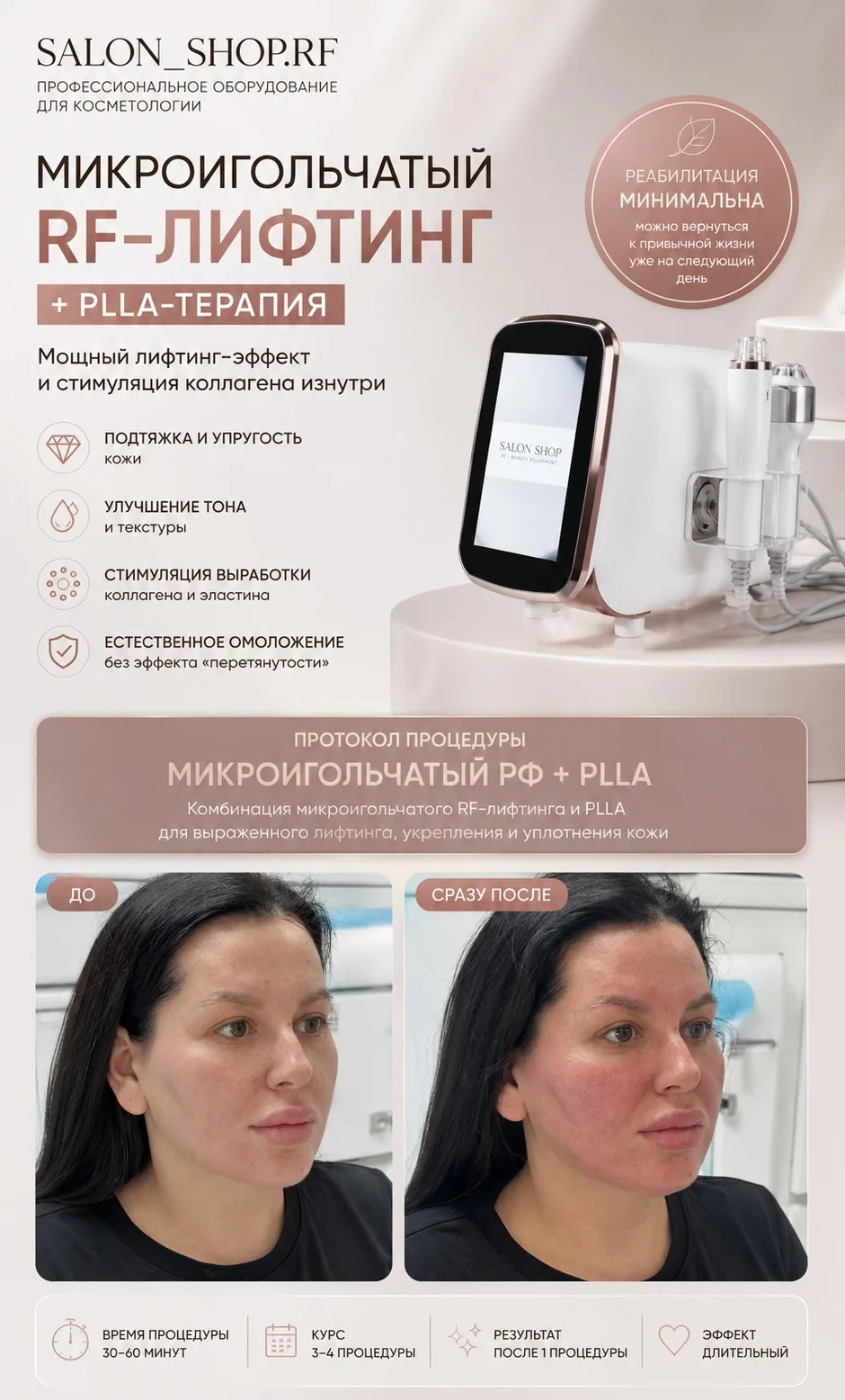 МИКРО в наличии для новичков ‼️