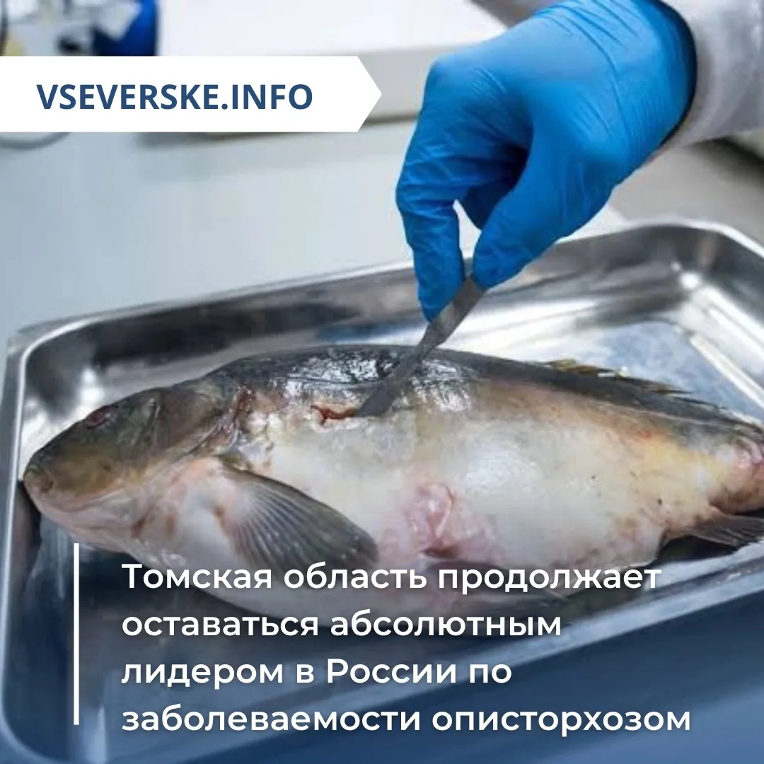 Томская область продолжает оставаться абсолютным лидером в России по заболеваемости описторхозом

По