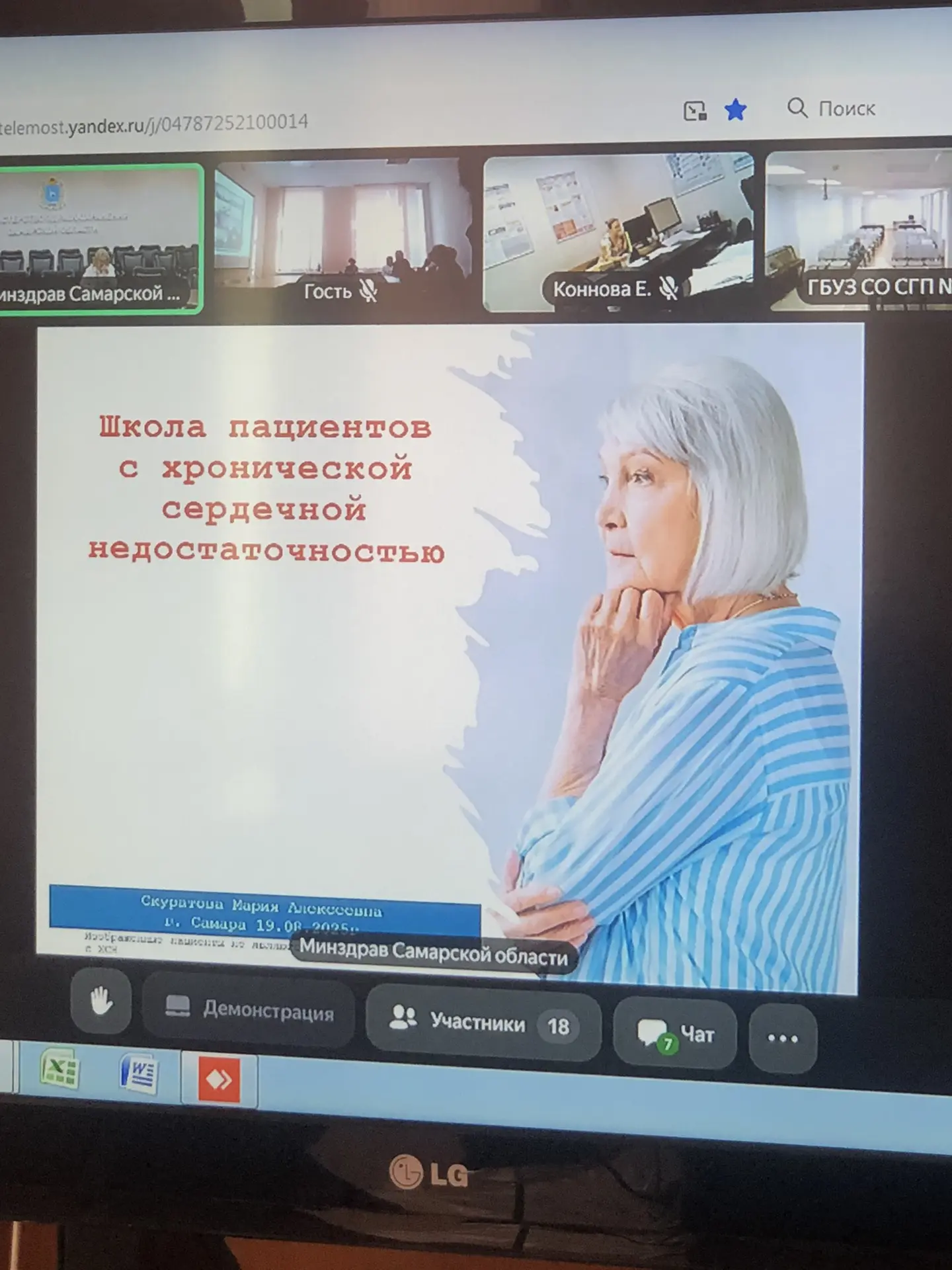 В День сердца о сердце с медицинской точки зрения