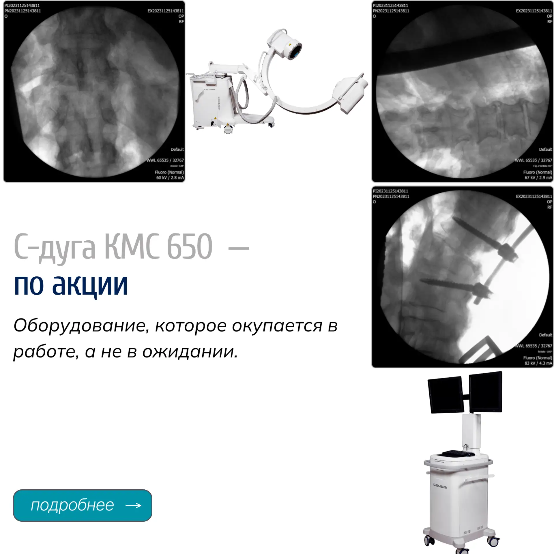 Акция на C-дугу КМС 650
C-дуга КМС 650 — надежное решение для интраоперационной визуализации, обеспе