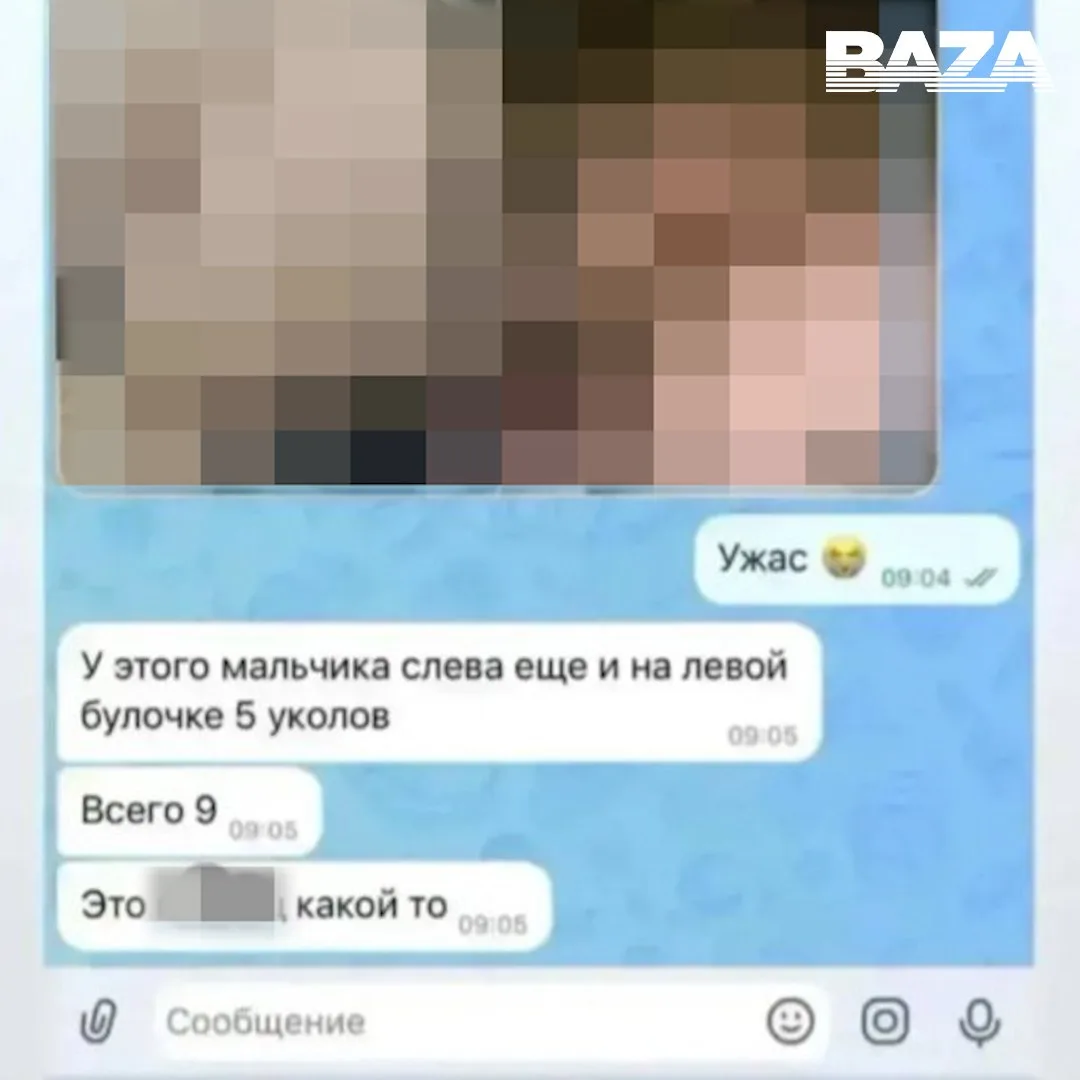 Следы от уколов обнаружили родители из Тывы на своих малышах после посещения детского сада — по их с