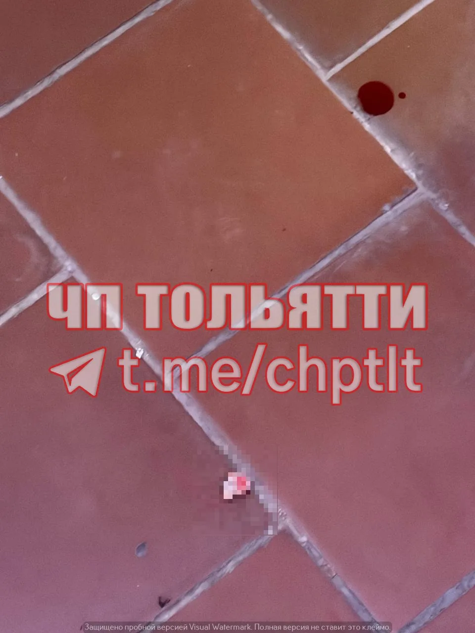 😱 В Тольятти школьница осталась без фаланги пальца.