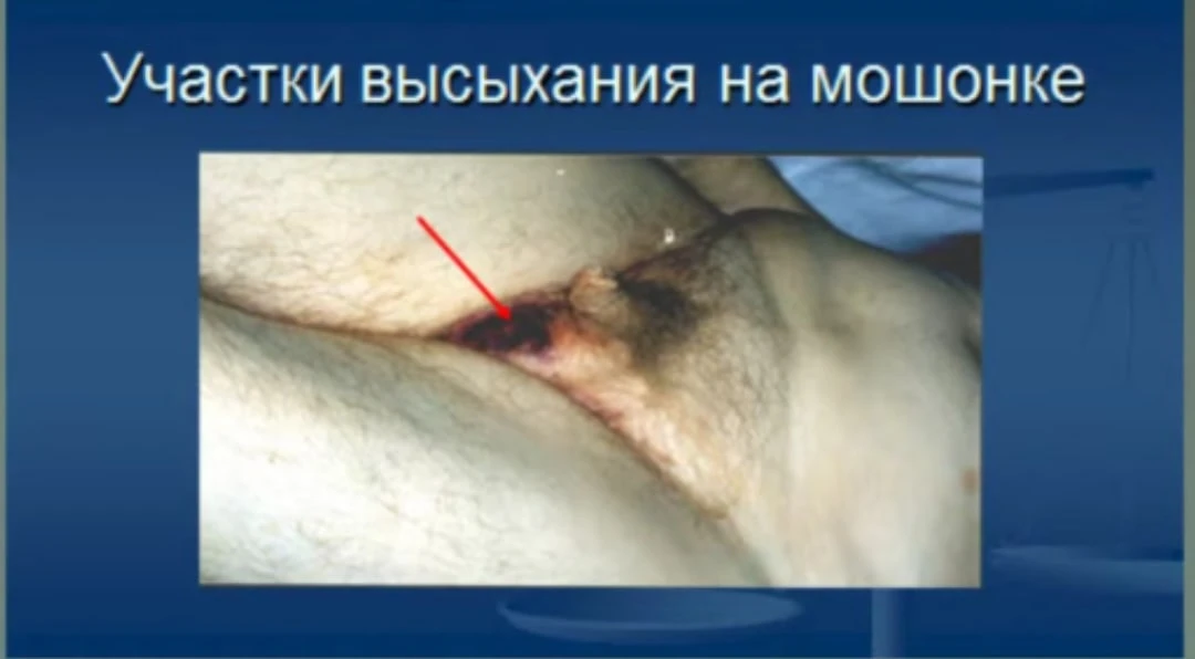 Опрос: vk.com/wall-188359135_266