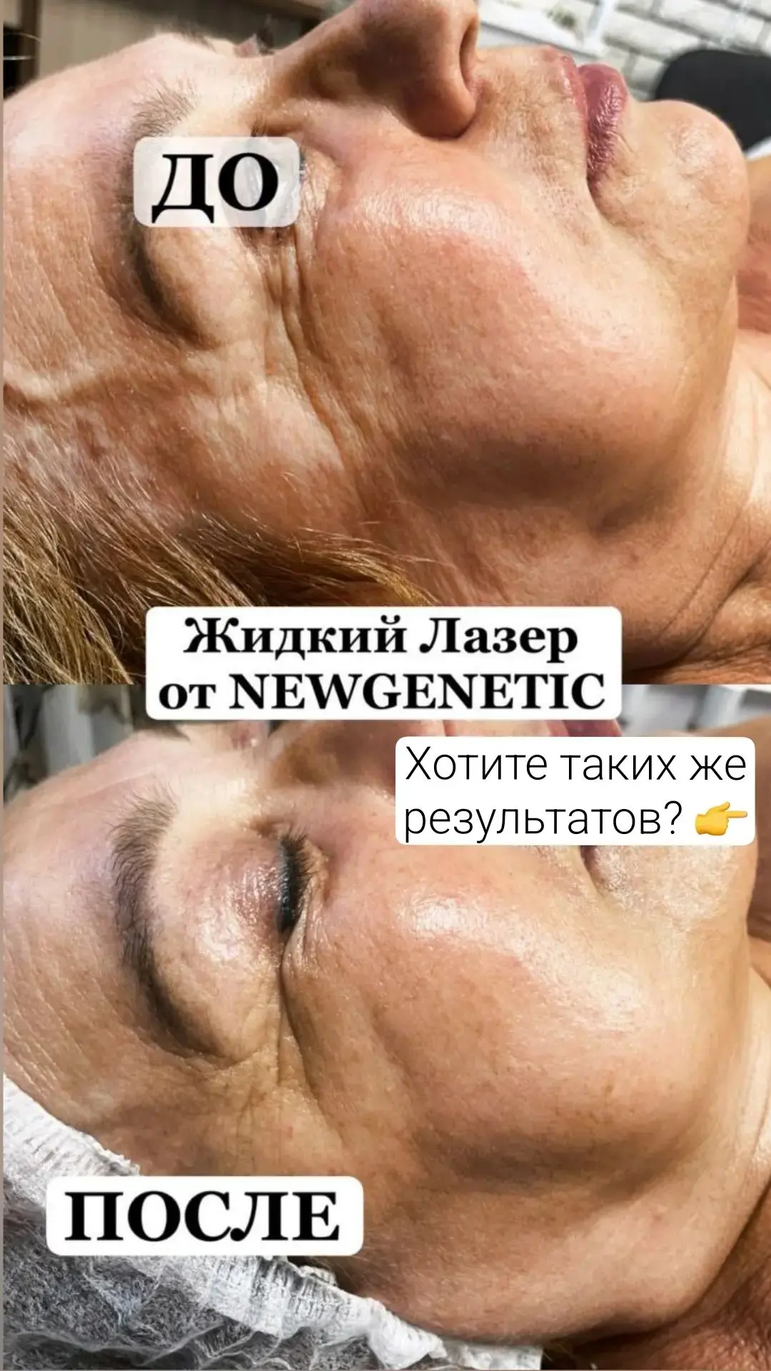 ‼️ Ещё можно успеть! До конца сентября действует предложение лицо +шея и декольте за 45...