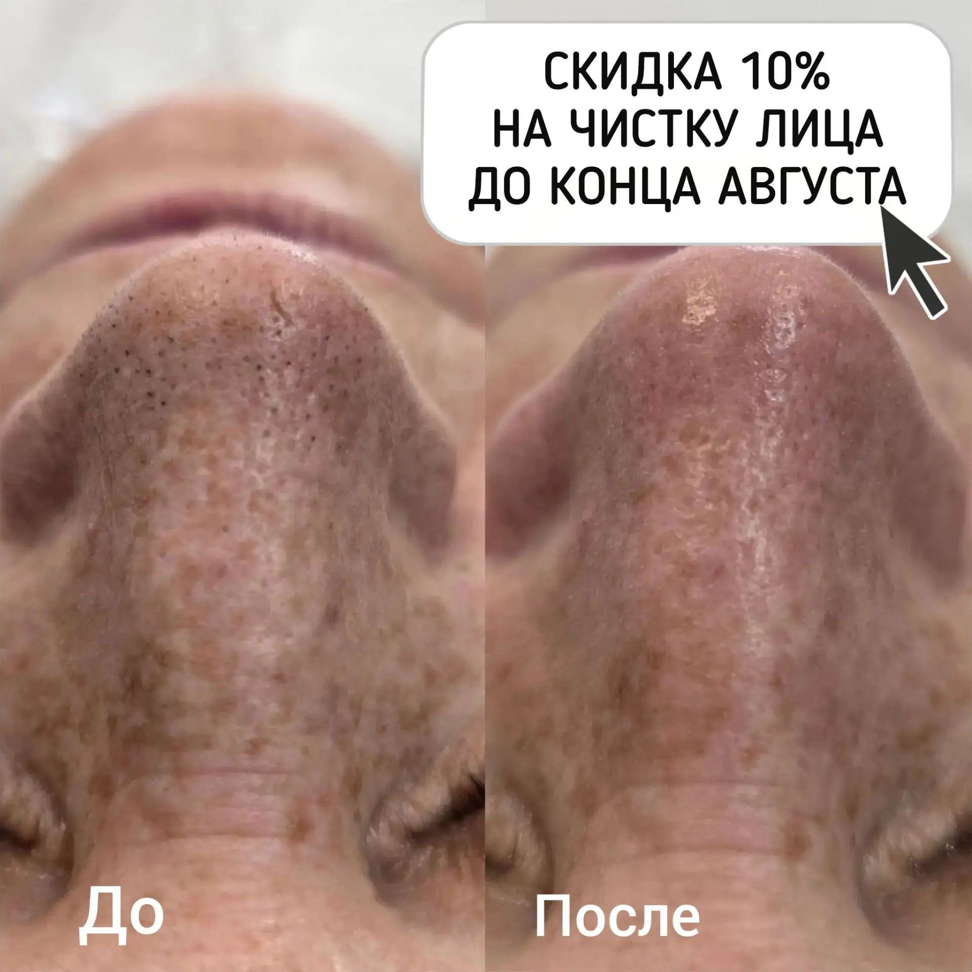 🧖 Думаете, умывания хватит, чтобы поры были чистыми?