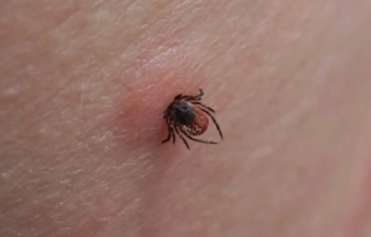 #цифра

🐞1371 пострадавший от укусов клещей в Курской области
 
💬 Об этом сообщает региональное Уп