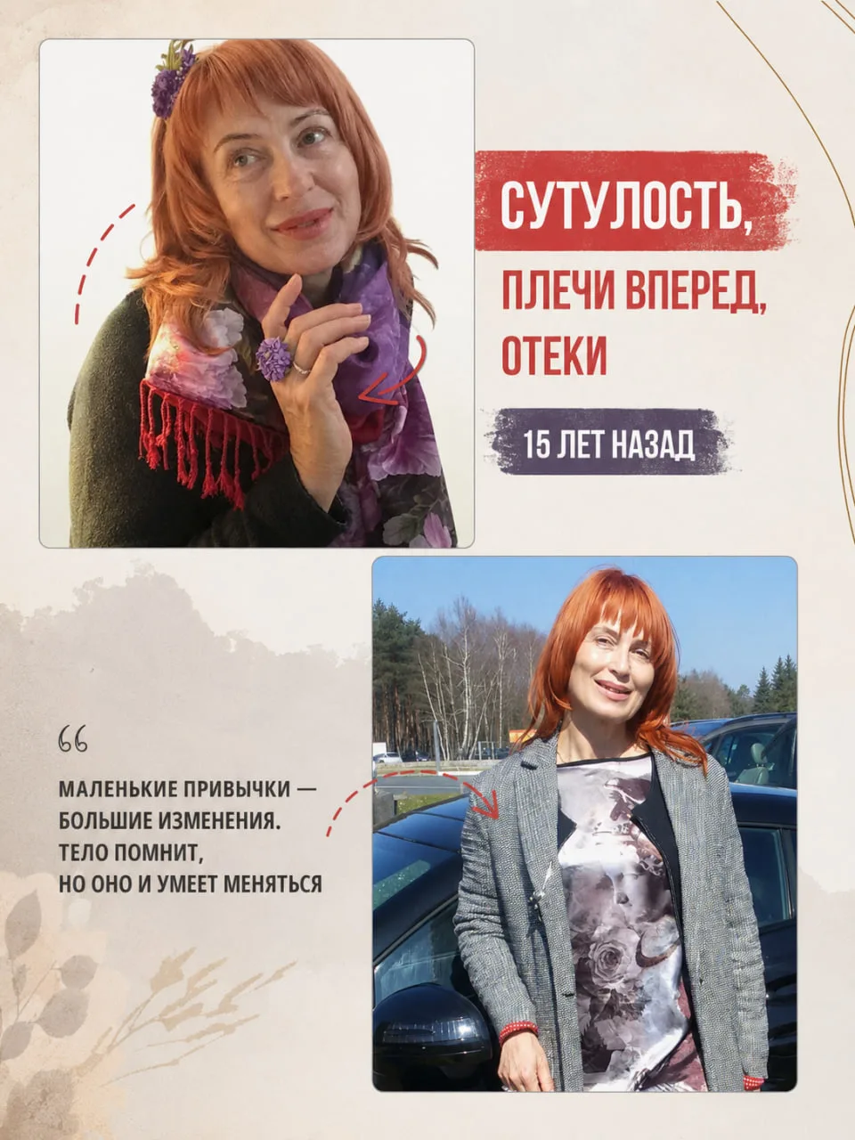 «Я просто привыкла сутулиться, с детства. Вроде расправляю плечи, а через 5 минут спина опять колесо