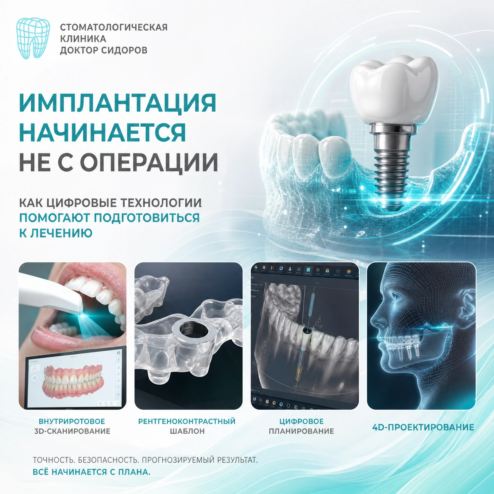 🦷 Имплантация начинается не с операции: как цифровые технологии помогают подготовиться...