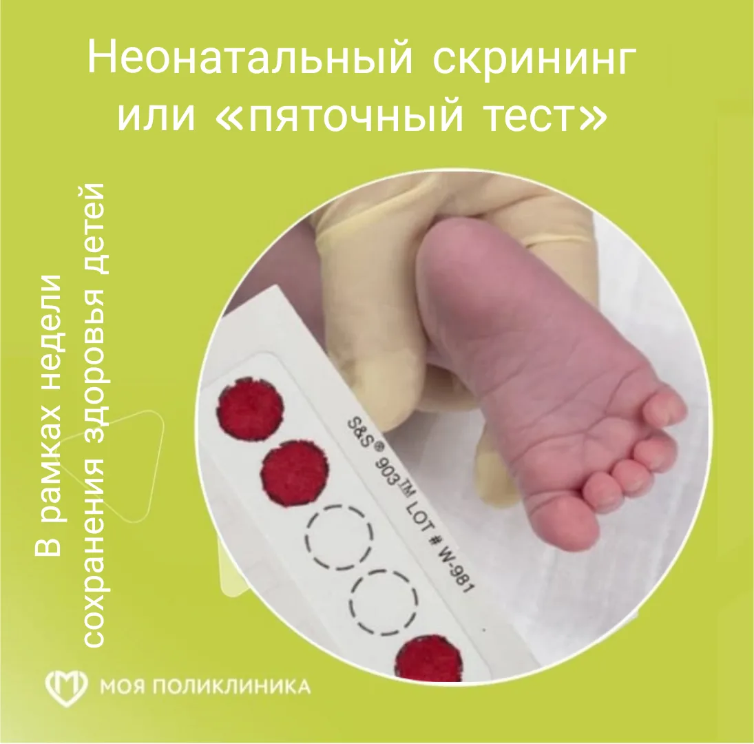 СКРИНИНГ НОВОРОЖДЕННЫХ