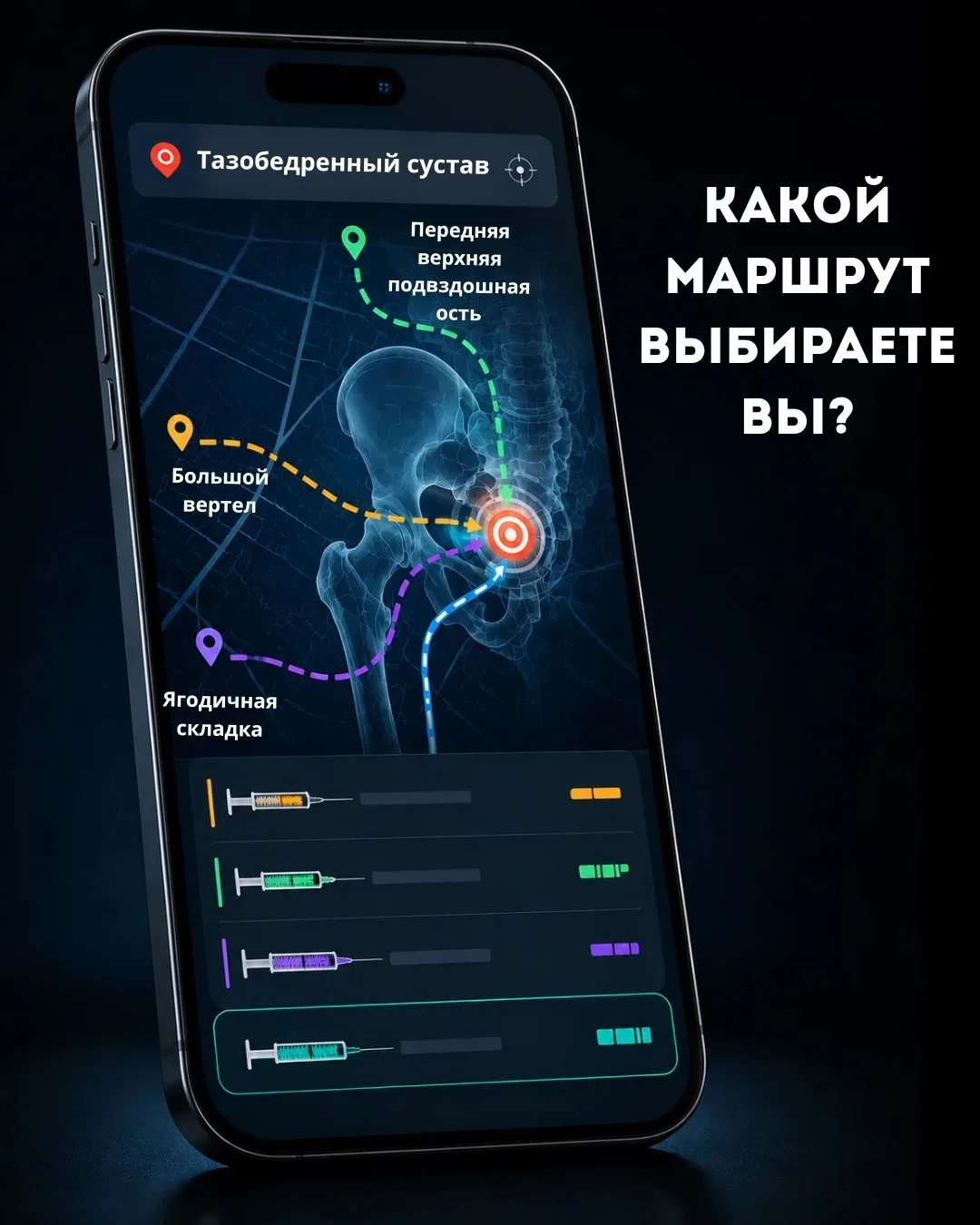 🎯 Попасть в тазобедренный сустав без УЗИ-навигации?