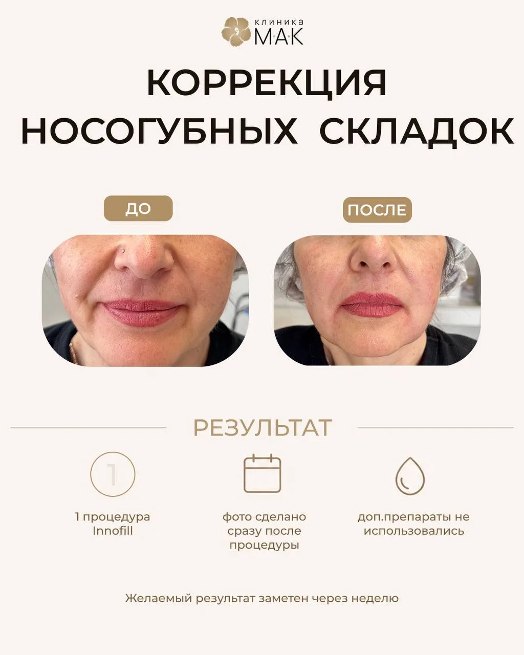 Кейс врача Марянян Марины Арменовны