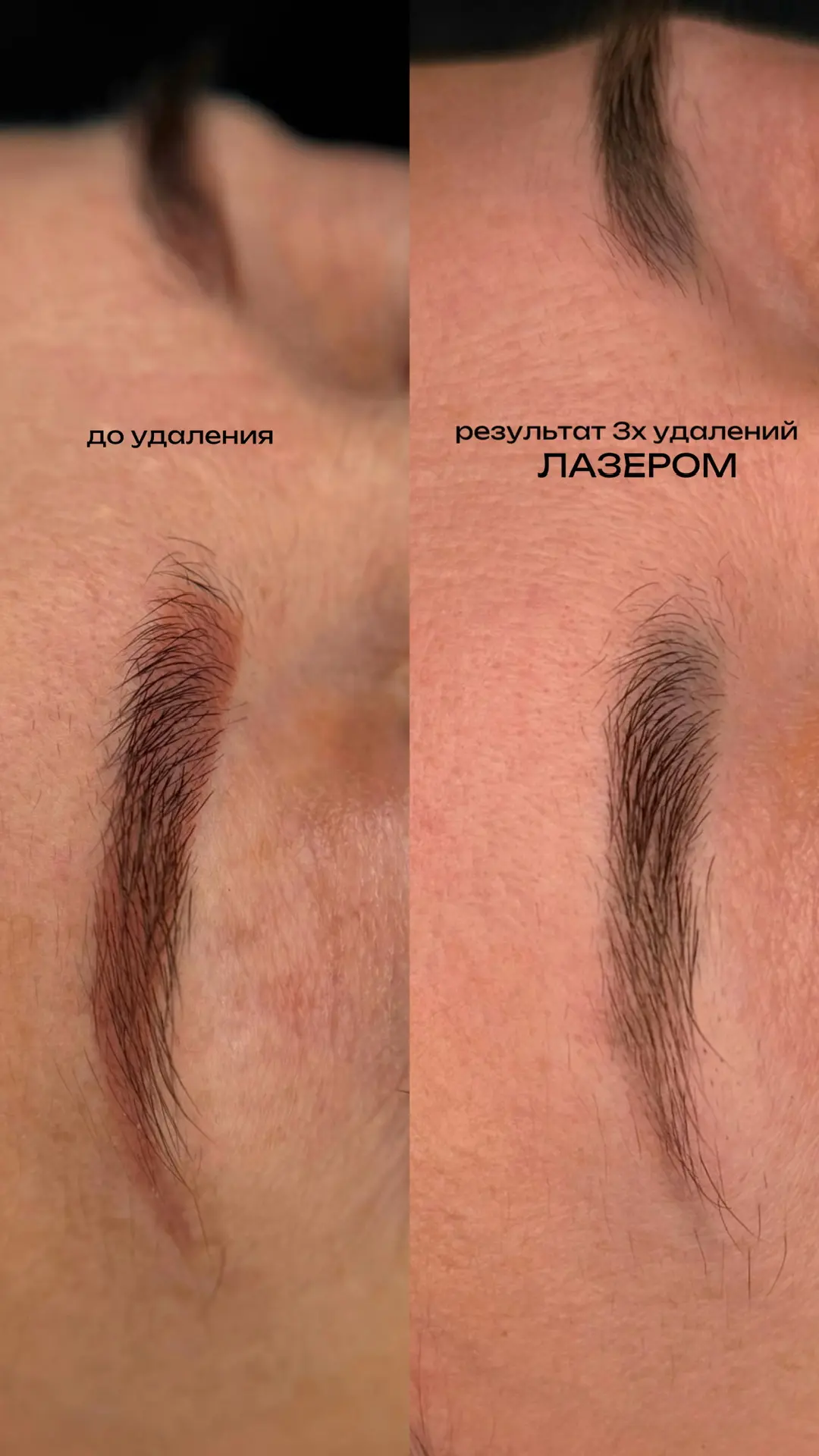 Надоели старые красные брови?