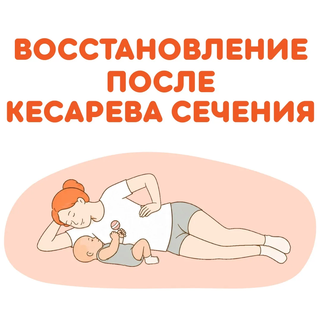 Поговорим про восстановление после КЕСАРЕВА СЕЧЕНИЯ

На слайдах рассказала:

- как вернуть чувствите