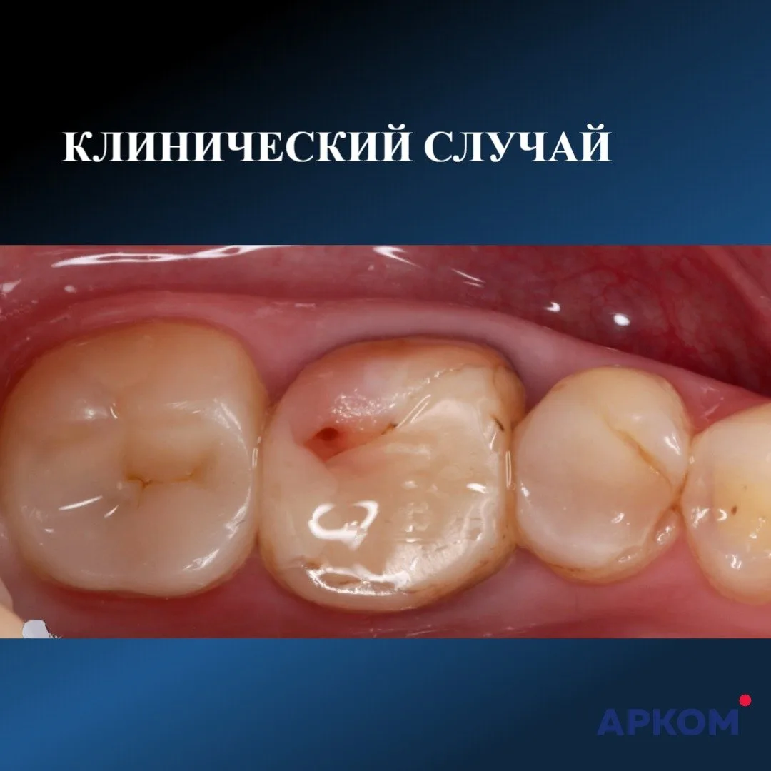 КЛИНИЧЕСКИЙ СЛУЧАЙ