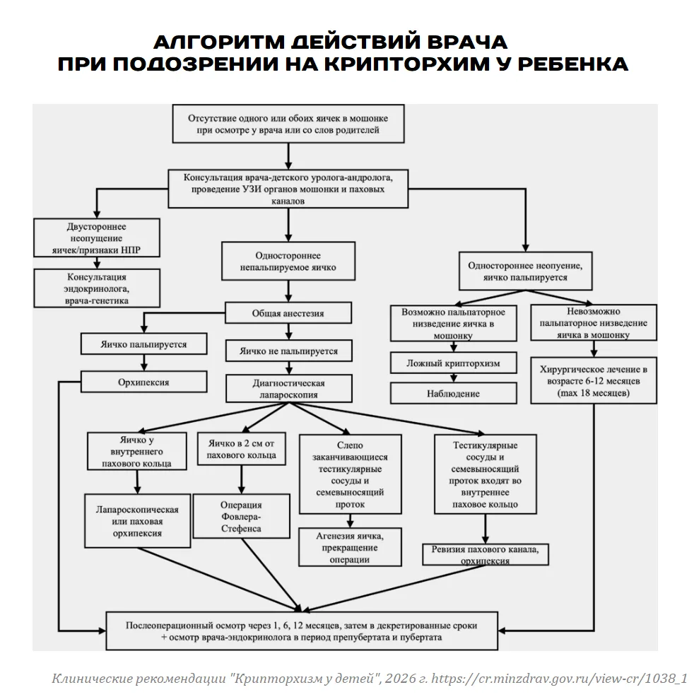 Спустя 11 лет обновлены клинические рекомендации по КРИПТОРХИЗМУ у детей

Ключевое:

🔹 Если яичко н