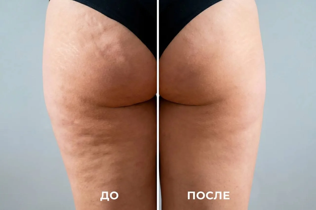 ❤️Массажер для тела KIO  от бренда WAU со скидкой 40% на оф.сайте – к лету супер!  + скидка 10% на В