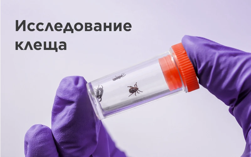 В микробиологической лаборатории ФГБУЗ ЦГиЭ № 81 ФМБА России осуществляются исследовани...