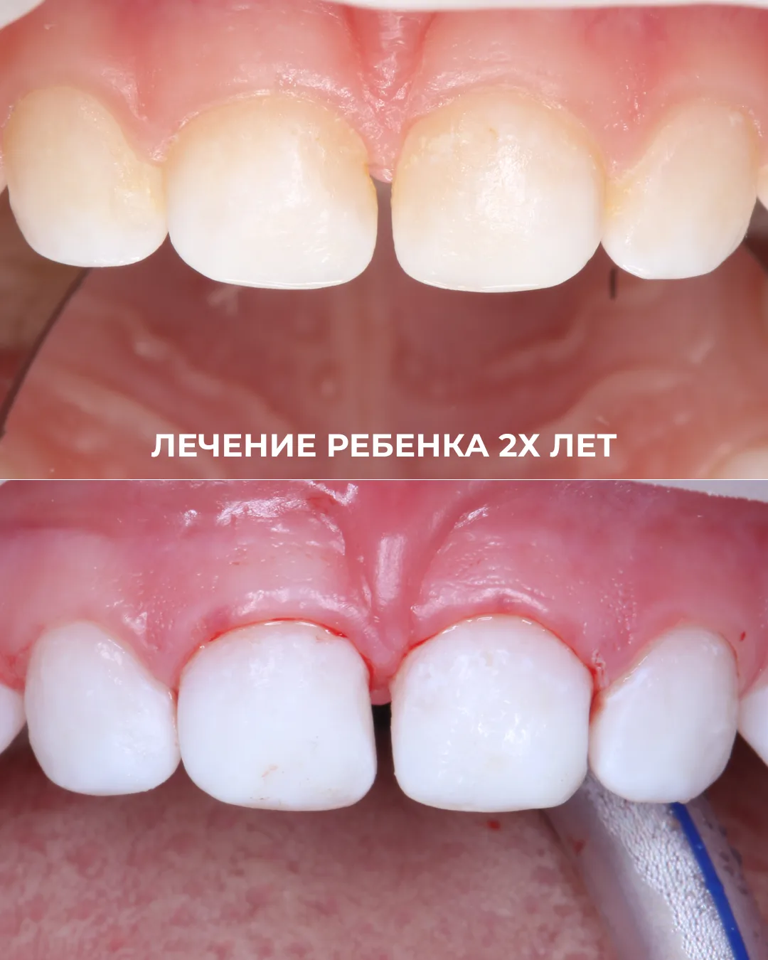 В нашем Центре стоматологии мы делаем все возможное, чтобы избежать ненужных процедур.
