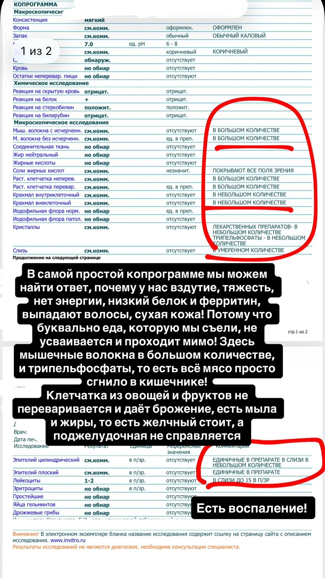 Самая простая Копрограмма даёт нам подсказки, как чувствует себя кишечник 🔥 разбираем на примере 🤗