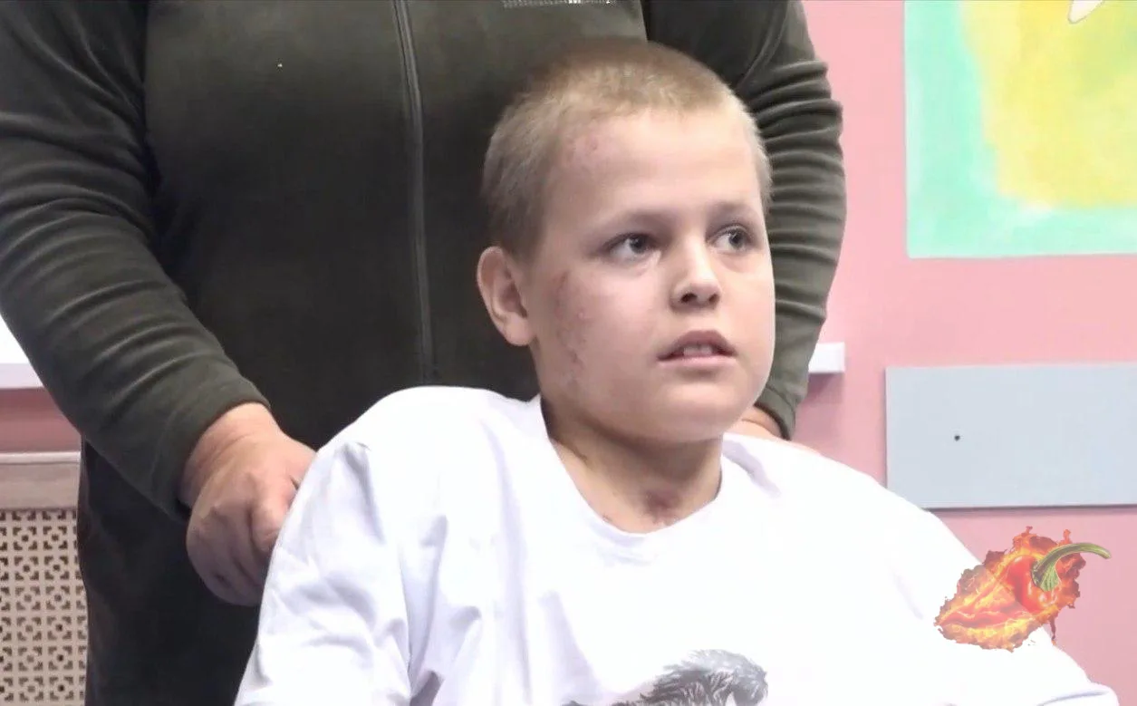 11-летний Илья спас котёнка и сам попал под КамАЗ — мальчик получил 19 переломов и пере...