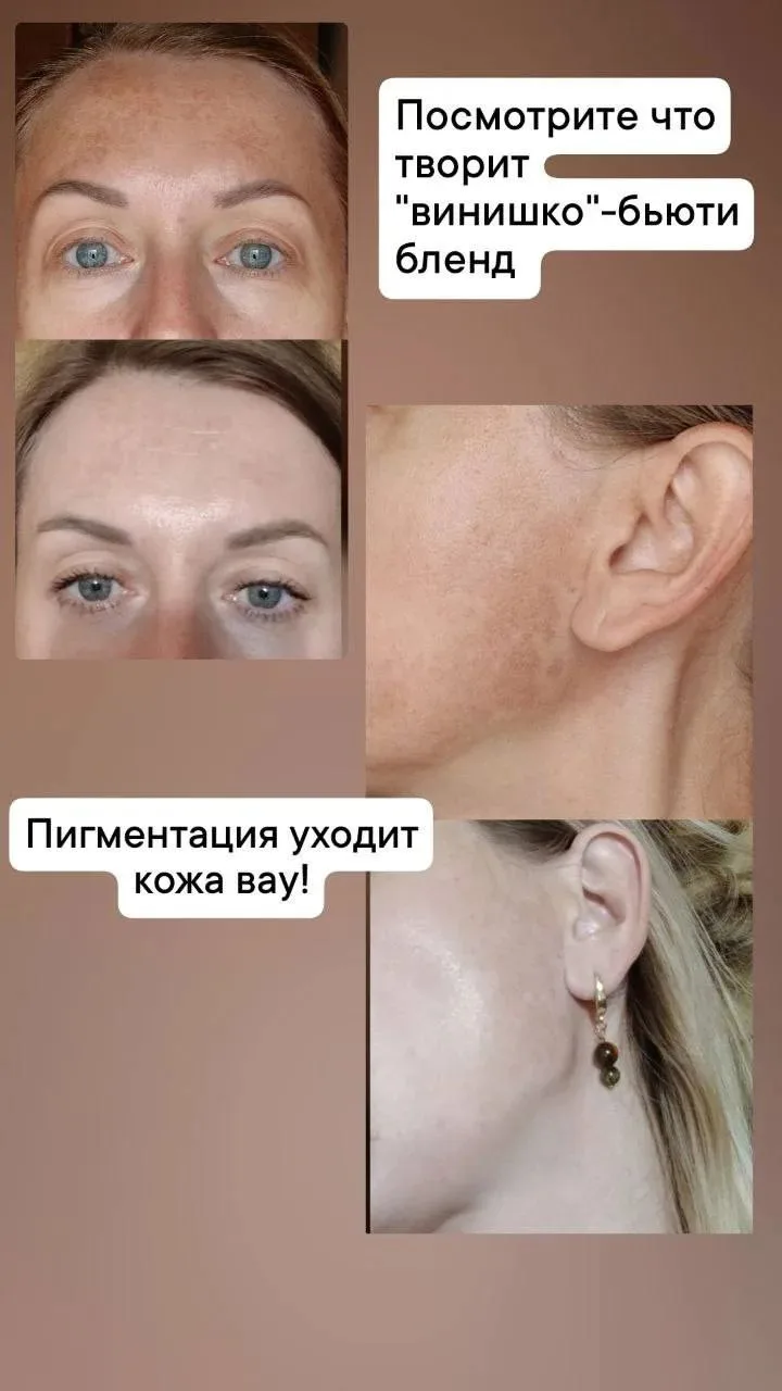 Отзывы 🔥