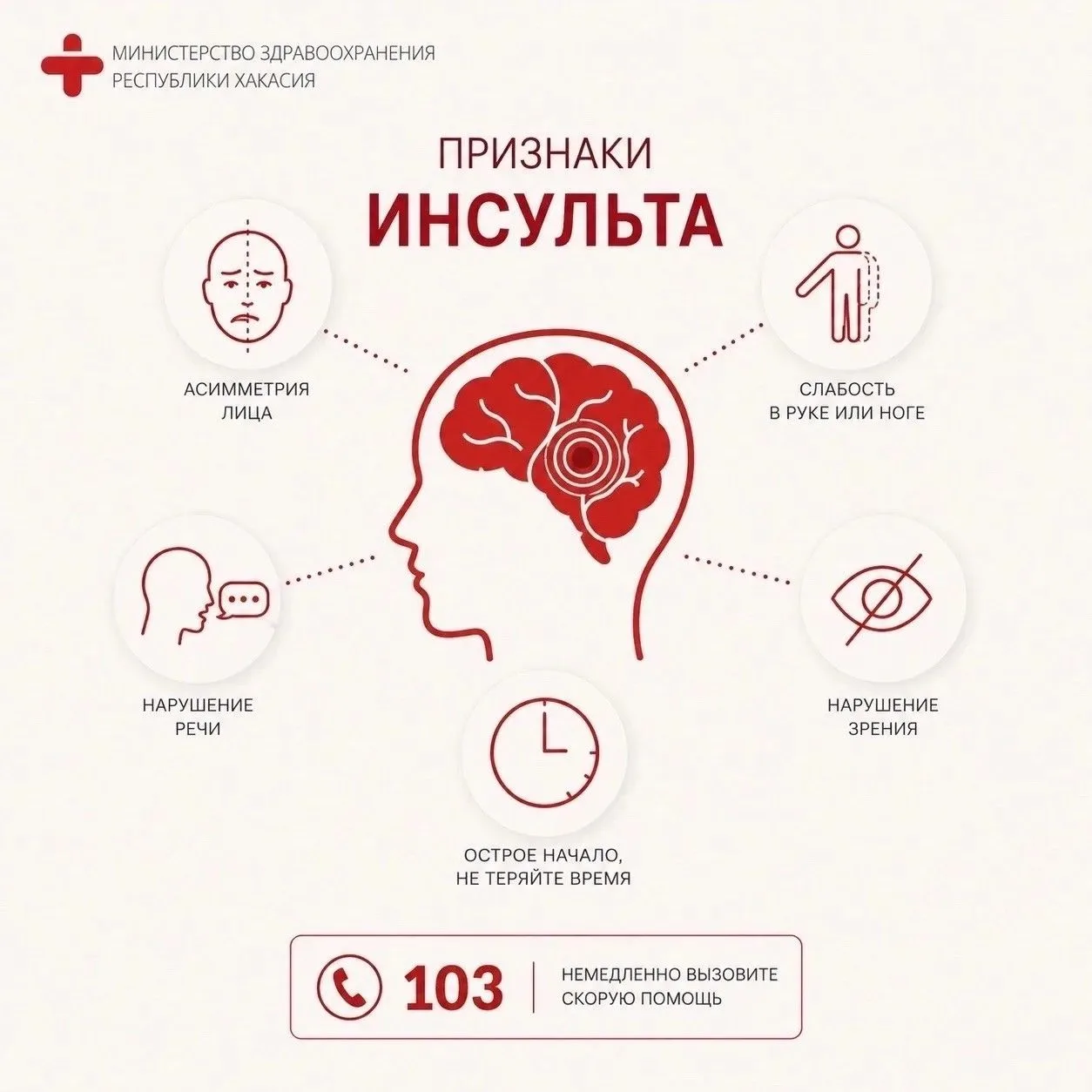 🧠Инсульт: как распознать и что делать?