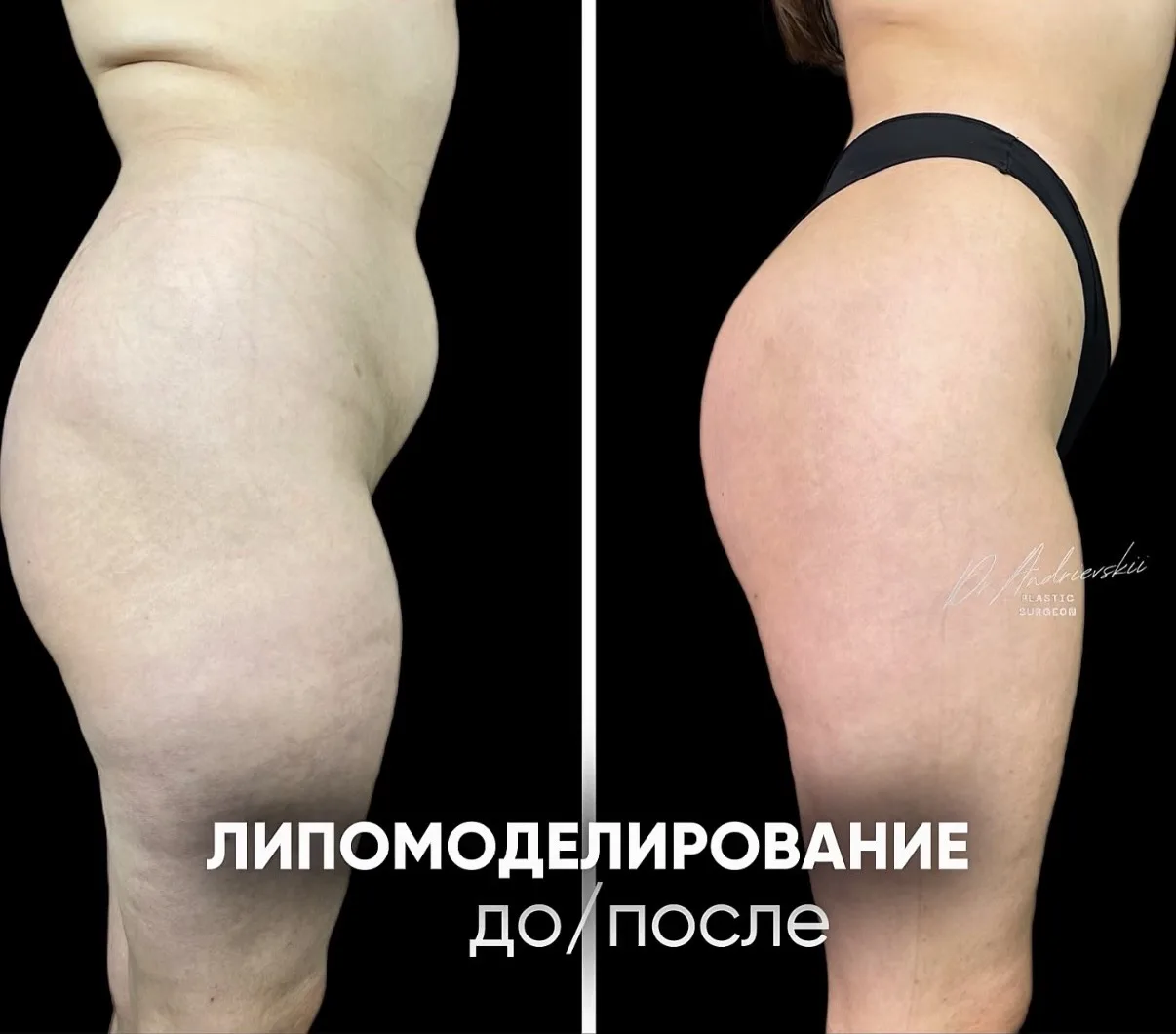 Осенью весь город — модный подиум!
