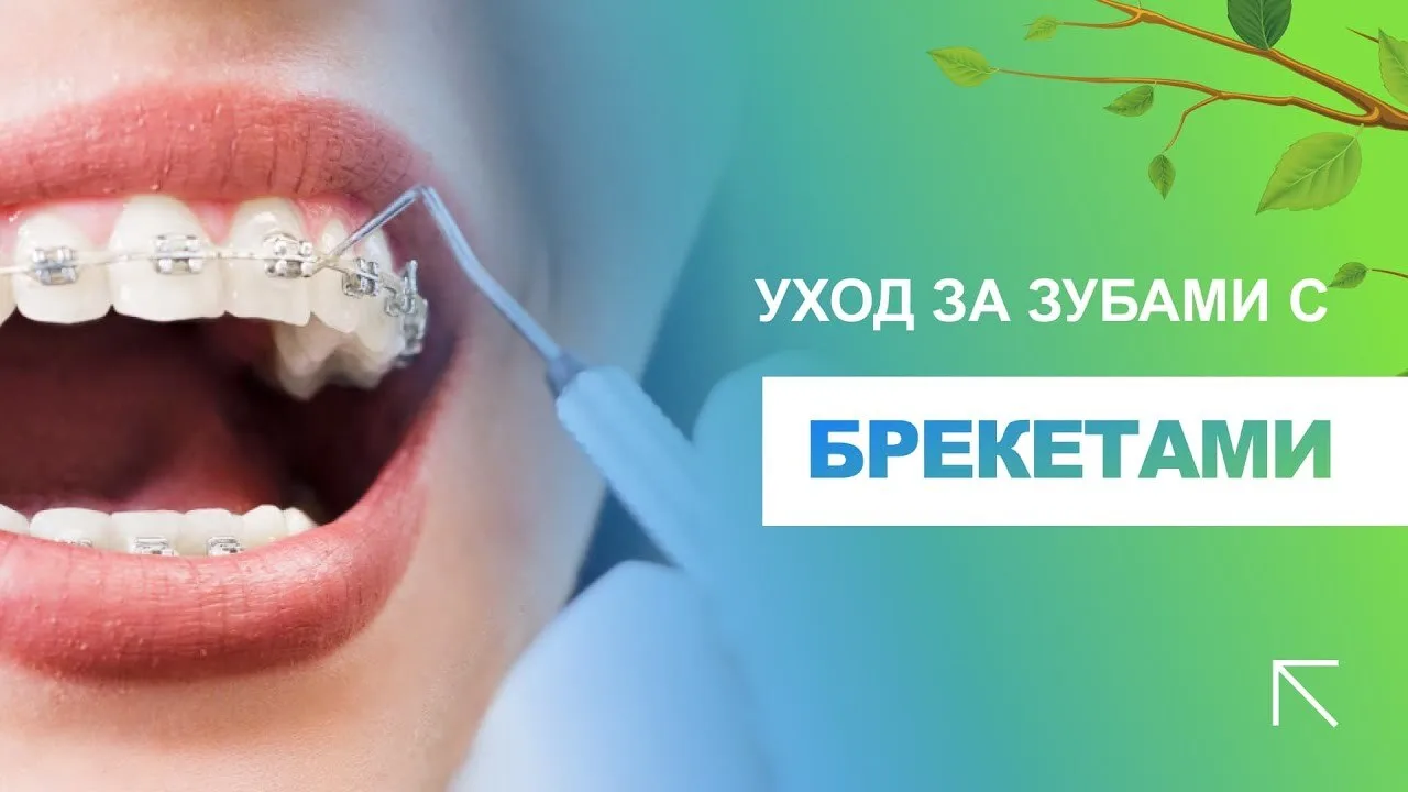 🦷 Все чаще среди своих знакомых, родственников и просто прохожих мы видим людей, испол...