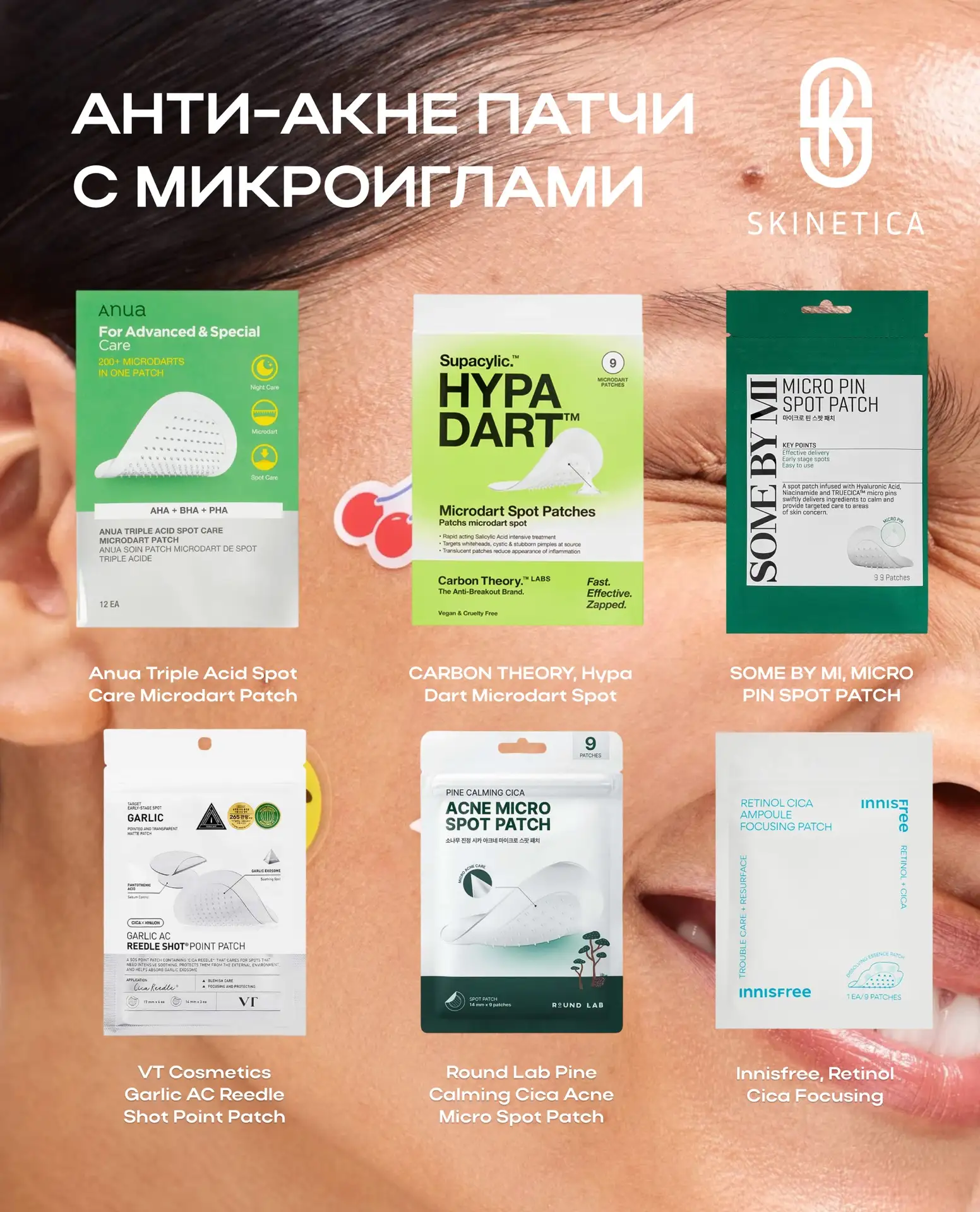 Патчи с микроиглами при активных воспалениях  На прошлой неделе делала для вас подборку точечных сре