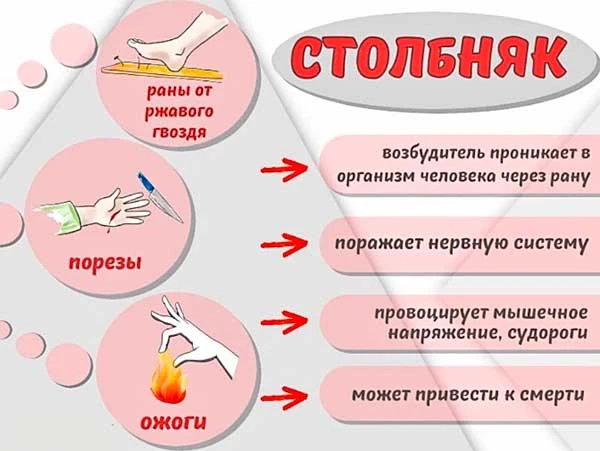 Столбняк – история заболевания.