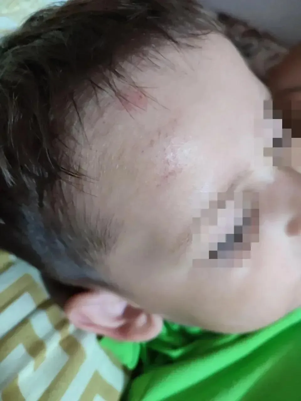 В Новосибирске яжемать с ноги ударила ребёнка в голову за то, что он случайно задел её дочь

Мальчик
