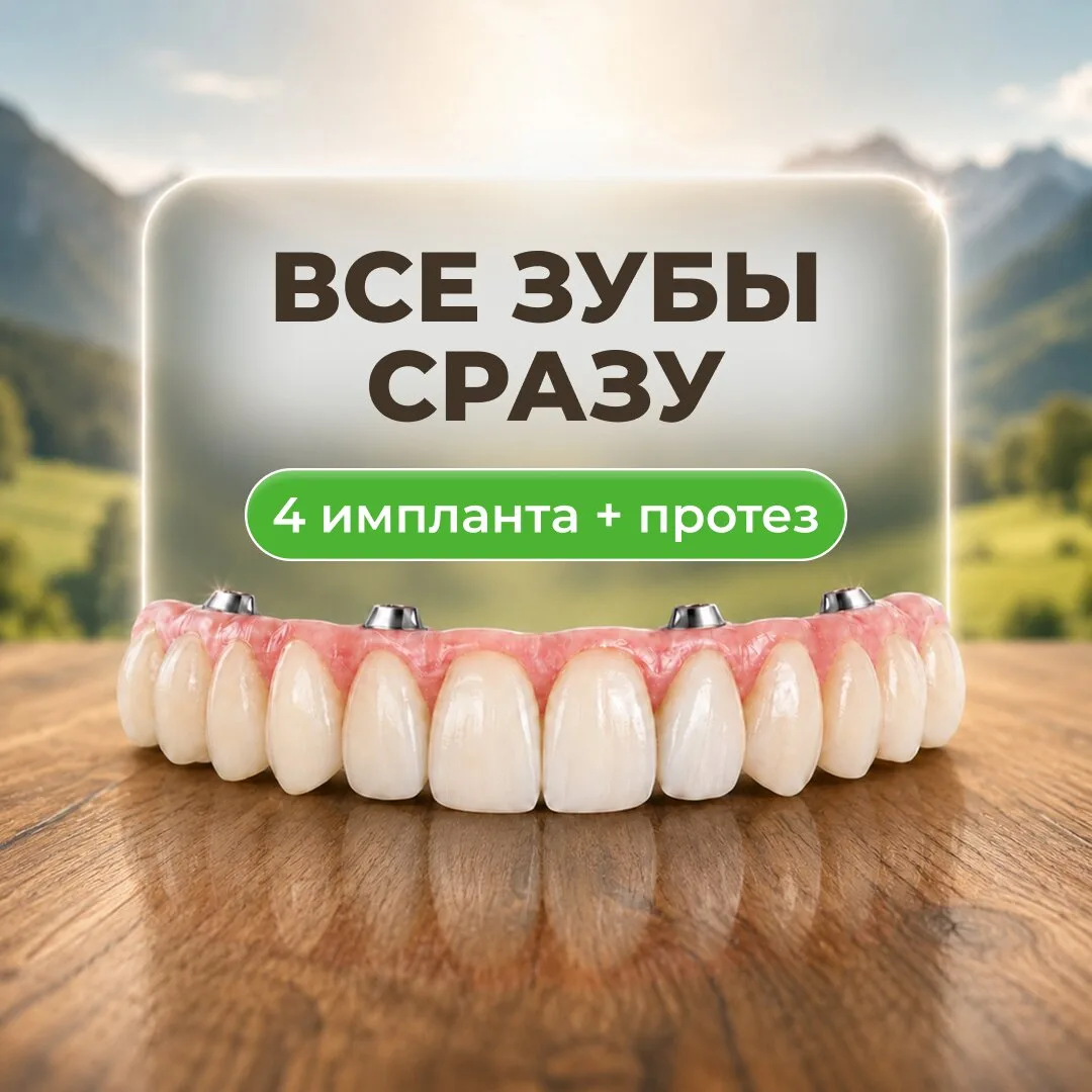 Имплантация всех зубов на 4-х от 90 000 ₽ в Краснодаре
