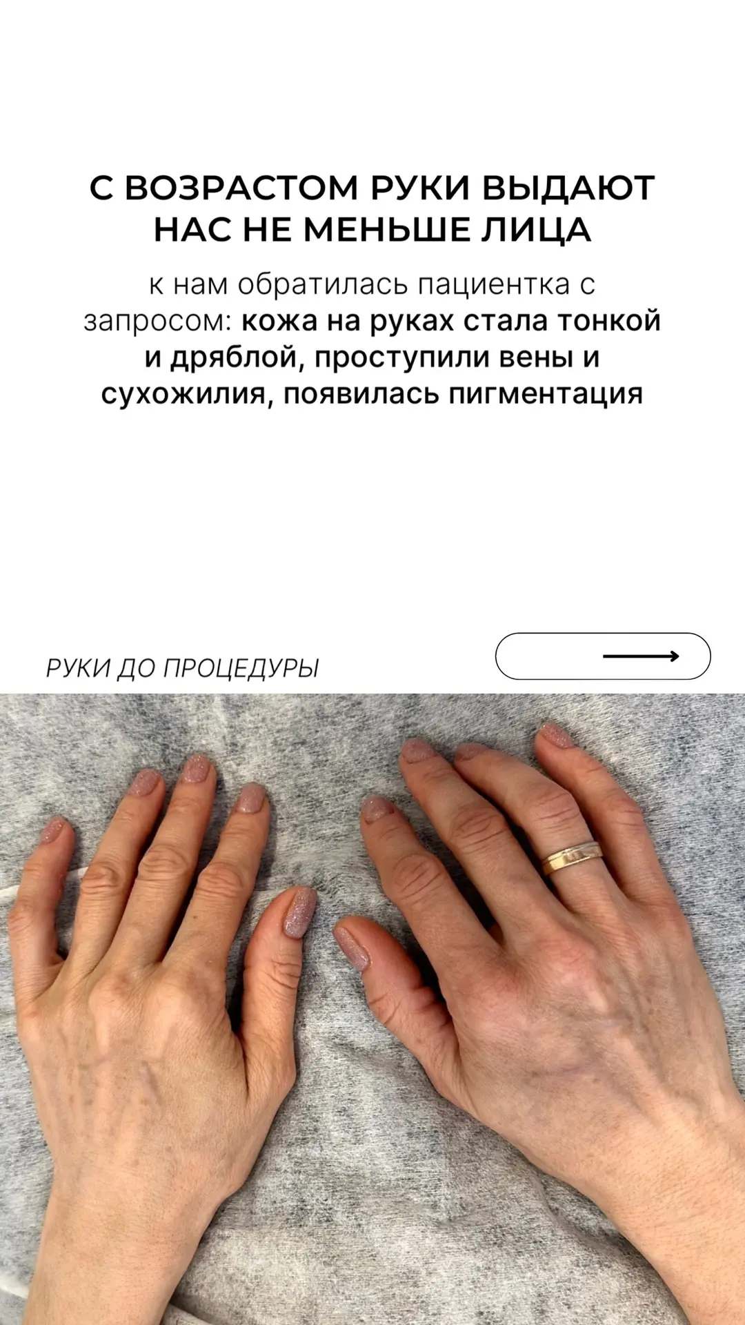 Молодые руки в любом возрасте⚡️

Руки всегда выдают возраст, но мы знаем, как вернуть молодость всег