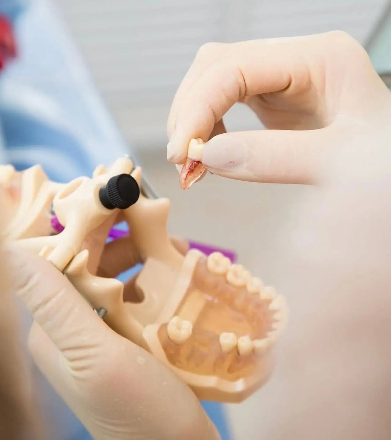 🦷Удаление зуба — это небольшое хирургическое вмешательство, но правильный уход очень в...