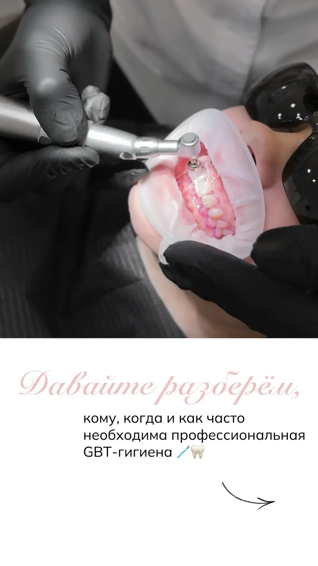 Кому, когда и как часто нужно делать профессиональную GBT-гигиену? Разбираем 👇🏻