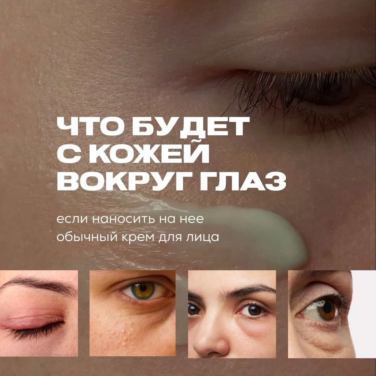 Что будет, если наносить обычный крем на кожу вокруг глаз? 🩷

В большинстве случаев — ничего страшн