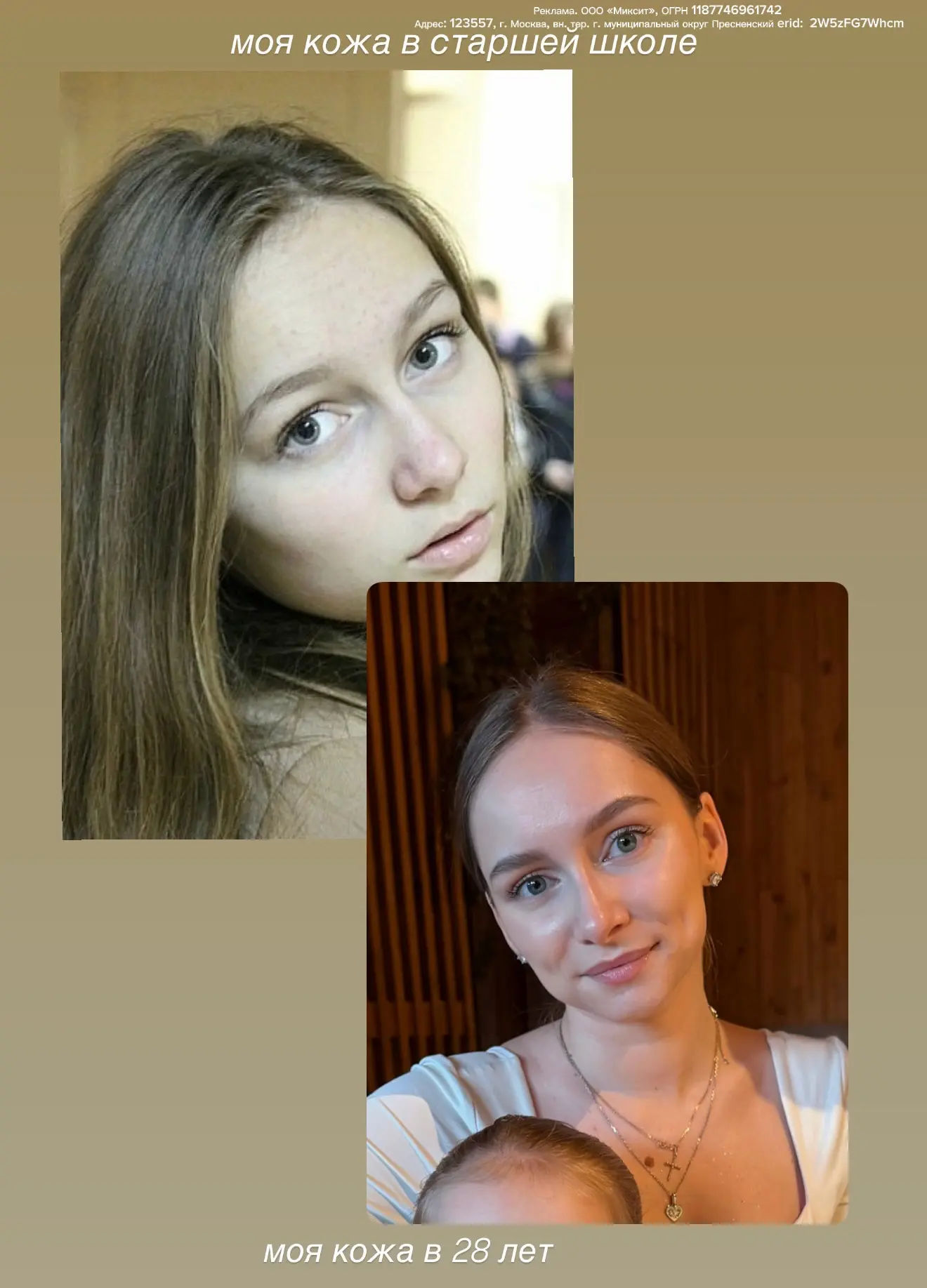 Пост-шок для тех, кто до сих пор думает что домашний уход за кожей не важен🙈 
📸Первое фото - я в с