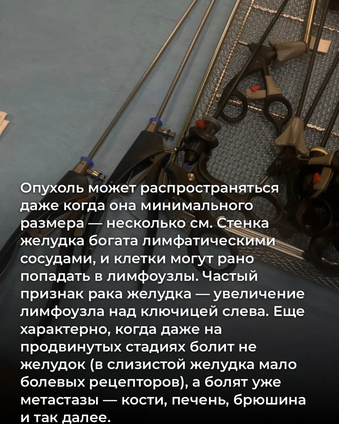 За последние 100 лет заболеваемость желудка снизилась почти в 5 раз. Виноваты в этом холодильники (с