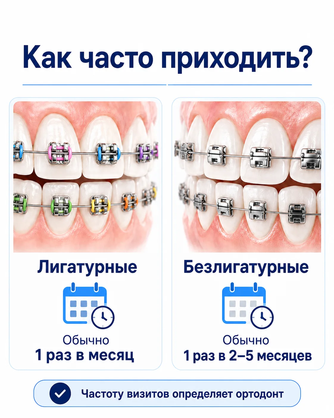Наглядно об отличиях лигатурных и безлигатурных брекет-систем.