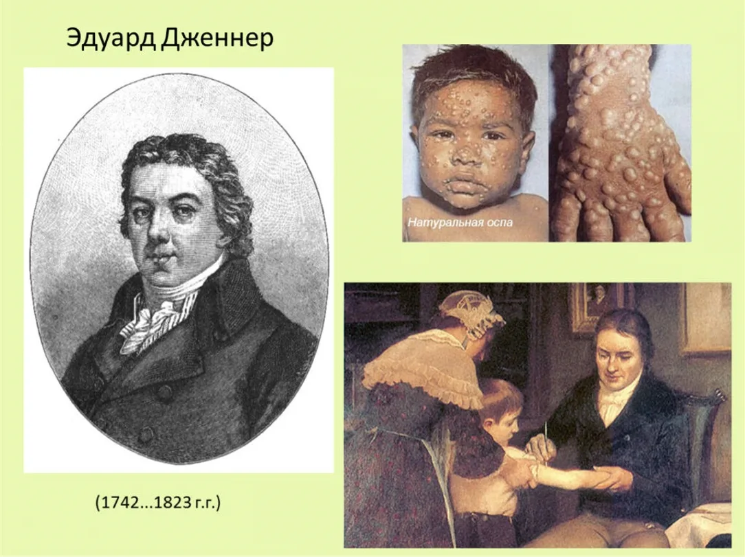 9 декабря отмечается Всемирный день ликвидации натуральной оспы.
