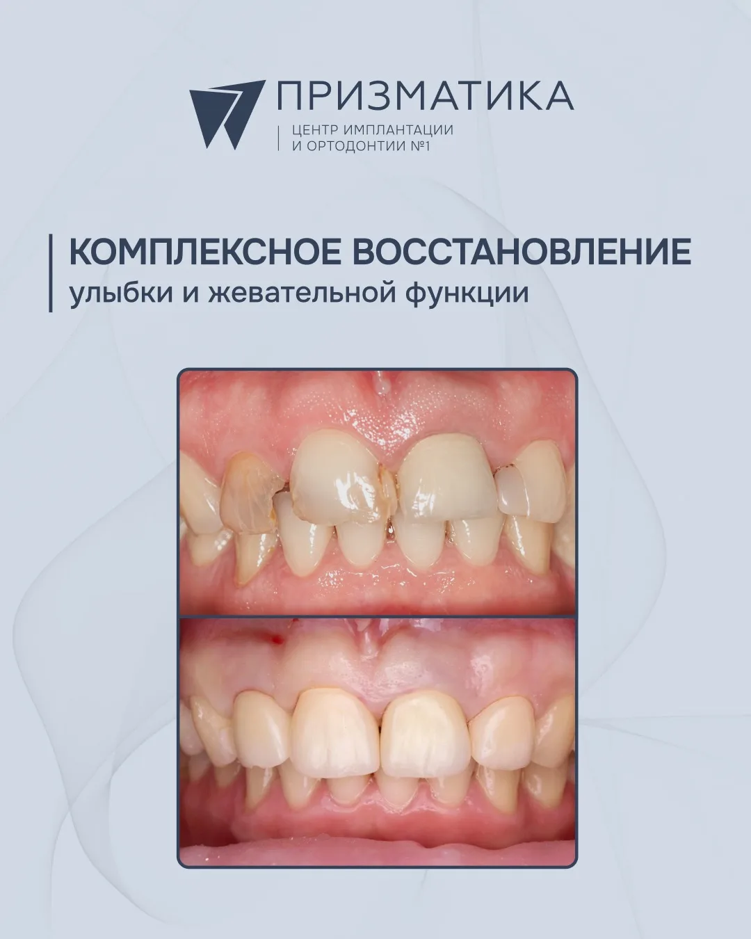 История одного клинического случая: от первичной диагностики до полной реабилитации с п...