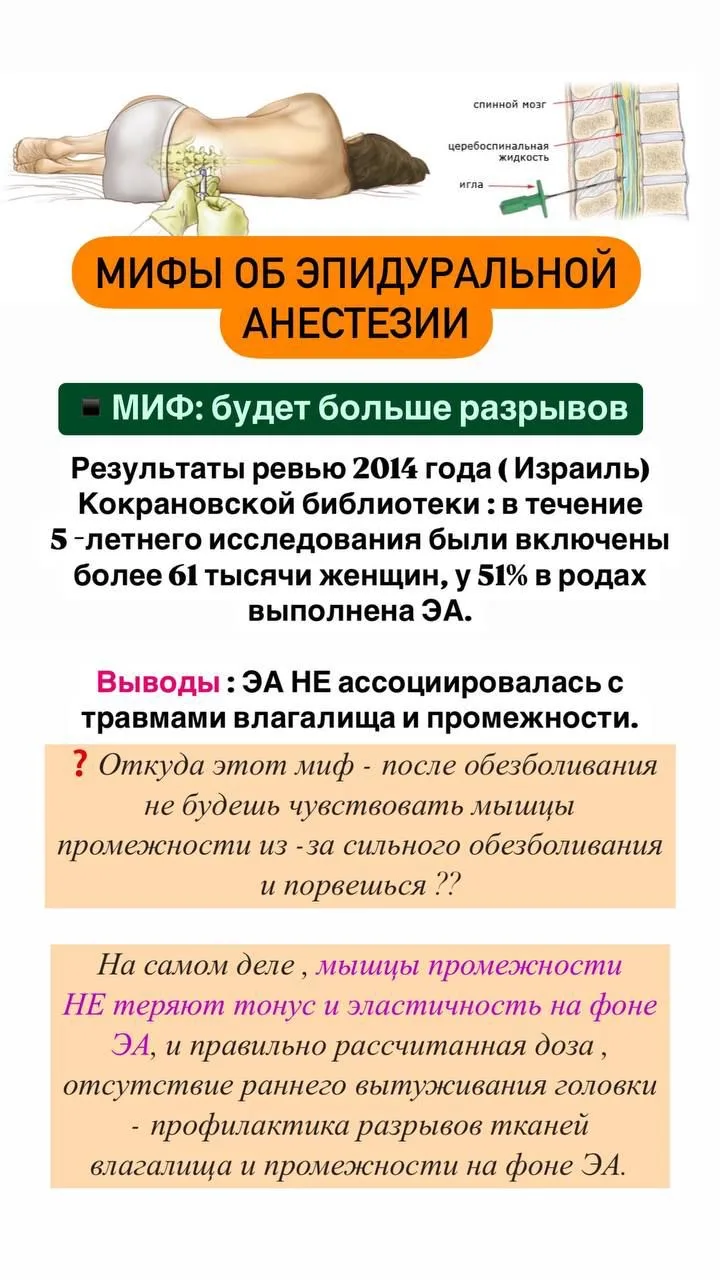🔴Мифы об эпидуральной анестезии