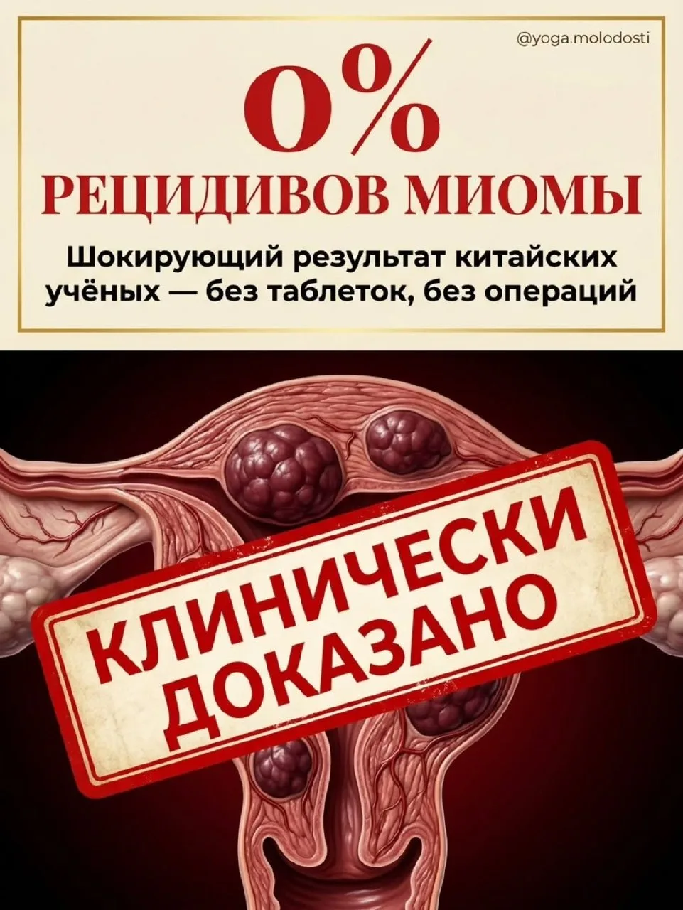 «А миому правда можно убрать без операции?» 🧐