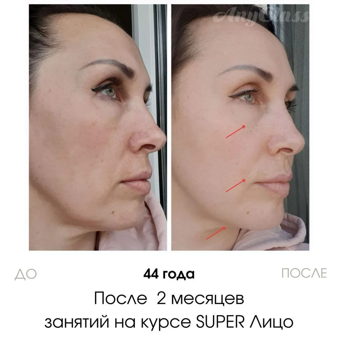 «Я не верю в гимнастику для лица! И не верю, что вы ничего с собой не делали» ⚠️ Гимнастика для лица