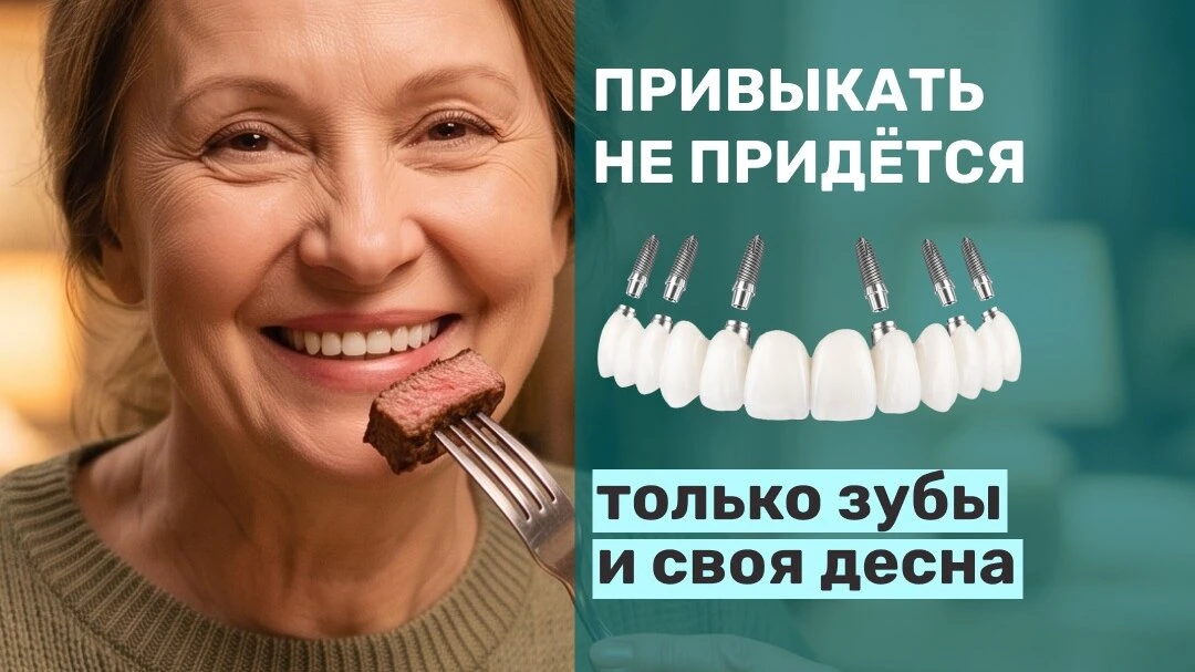 Новый метод имплантации зубов — без искусственной десны!