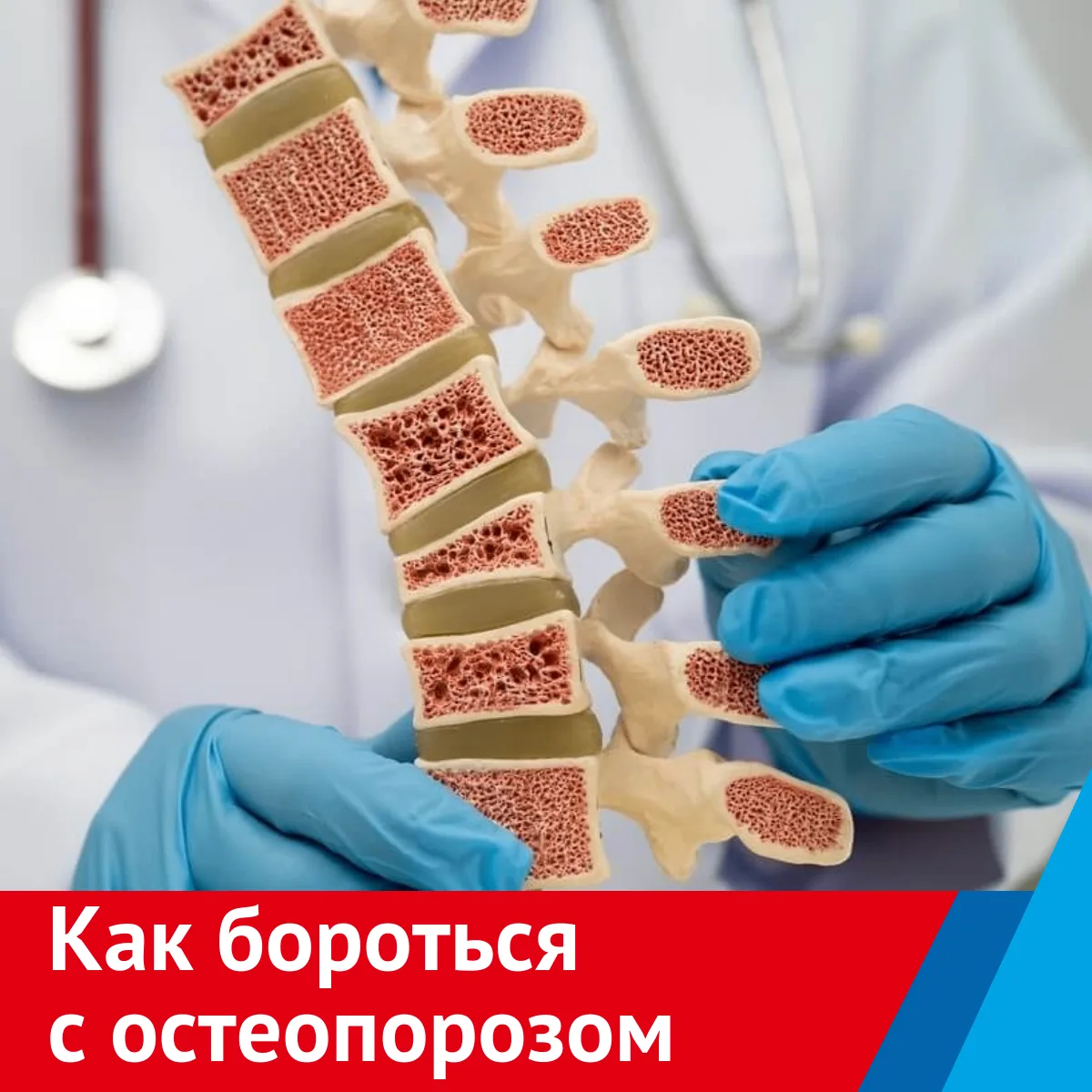 Как бороться с остеопорозом